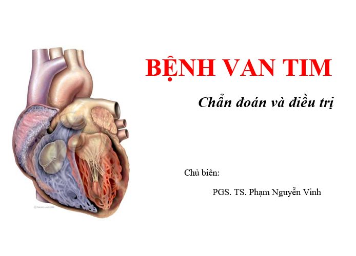 Bệnh van tim – Chẩn đoán và điều trị